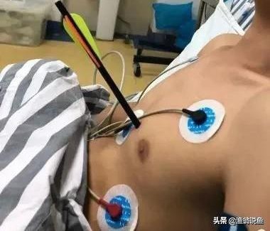 高效毒辣的“射鱼*党**”，诱人的鱼获下，却隐藏危机