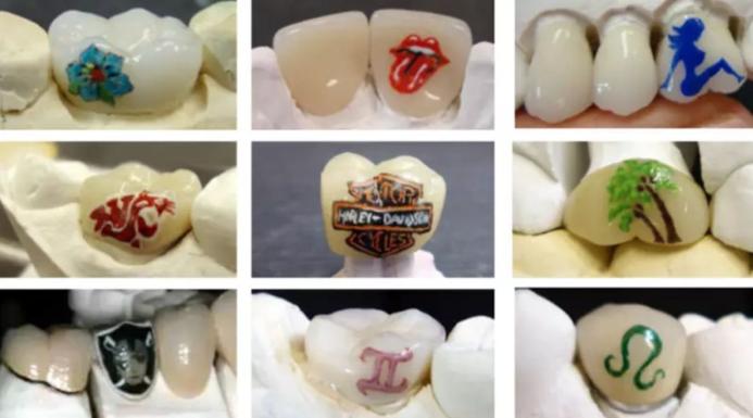 全球流行纹身,牙齿纹身图