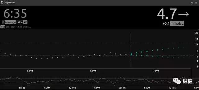 胰岛素泵闭环控糖效果,闭环胰岛素泵是什么意思