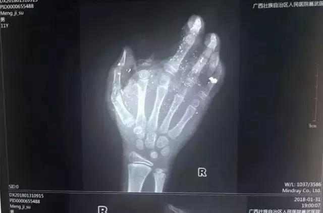 手机充电起火原因有哪些,手机充电不拔会起火吗