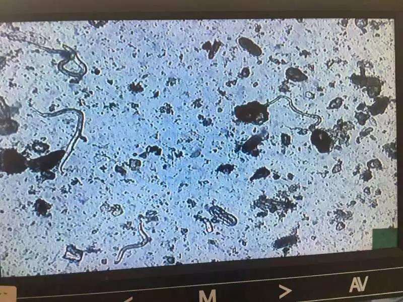 根结线虫病害及治疗方法,根结线虫危害全过程