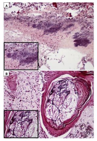 抗菌电纺百里酚负载聚己内酯垫的体内效应研究