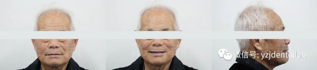 病例教学视频,病例分析操作技能