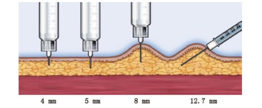 胰岛素病人科学用药指导,糖尿病胰岛素的正确使用方法