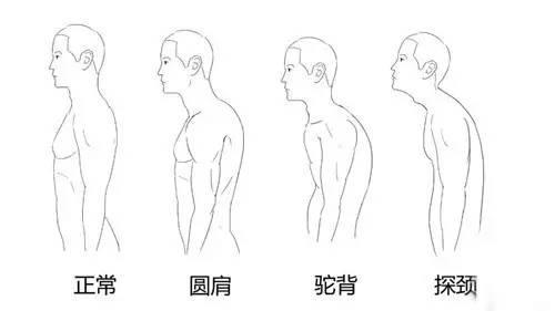 富贵包肩膀脂肪厚怎么消除,富贵包脖子前倾背厚快速消除方法