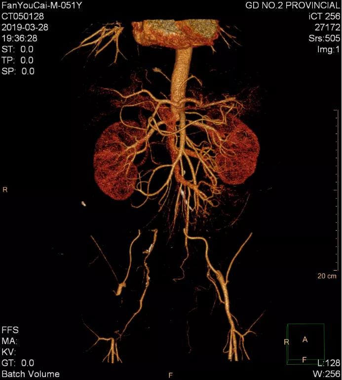 老烟民请注意,老烟民血管收缩