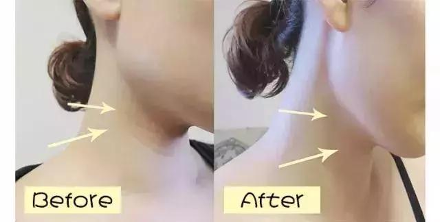 护肤太多的坏处有哪些呢,护肤越补越糟糕