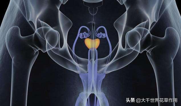 前列腺钙化灶是怎么产生的,前列腺钙化灶是怎么形成的严重吗