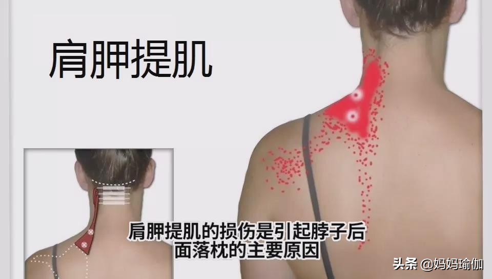 缓解落枕瑜伽,私教课的秘密