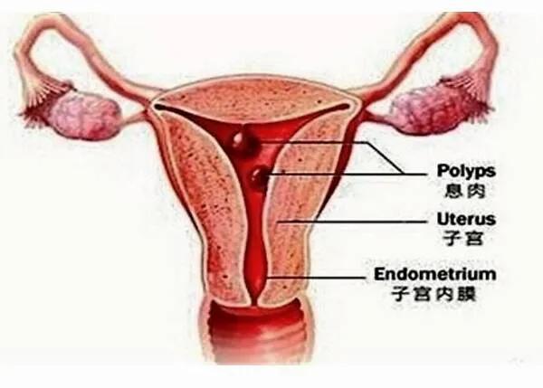 附着在子宫内膜上的种子是什么,子宫内膜卵子