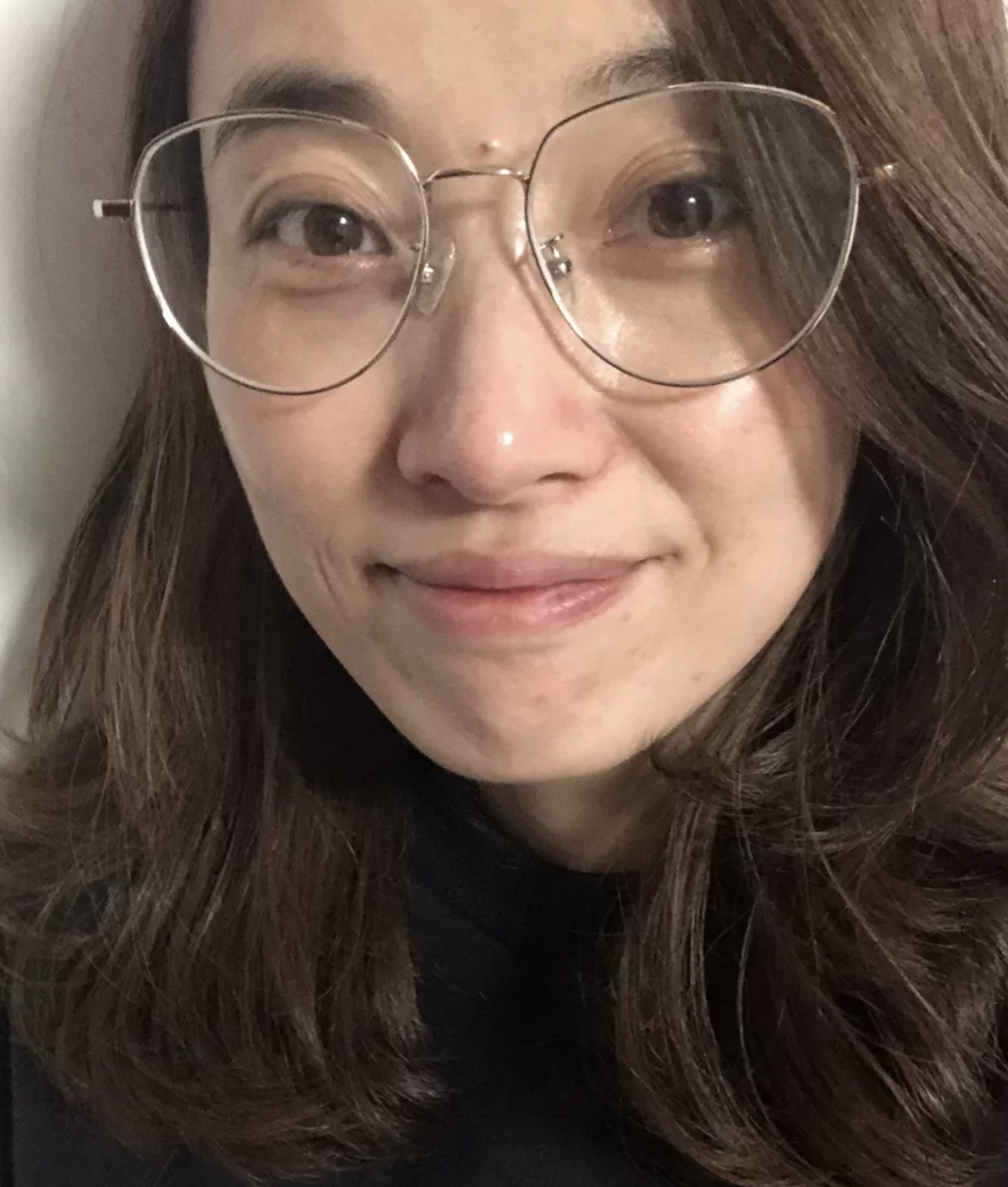 笑起来虽然有点皱纹但更喜欢大笑,一笑脸颊的皱纹很明显怎么办