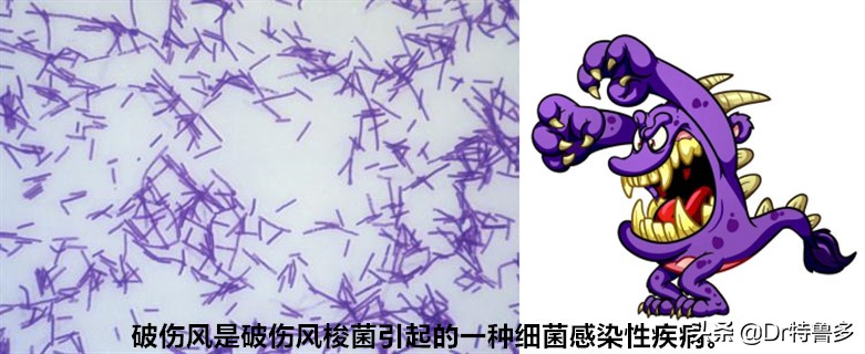 摔水泥地上擦伤会得破伤风吗,骑电车摔跤擦伤要打破伤风吗