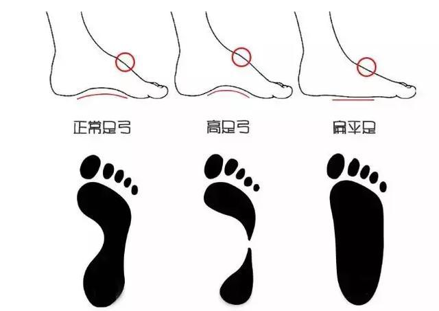 怎样选适合脚型的鞋子,找到一双显脚型好看的鞋子