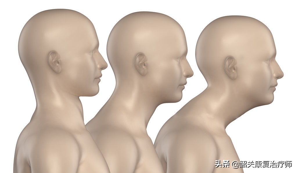 肌筋膜训练,肌筋膜手法是什么