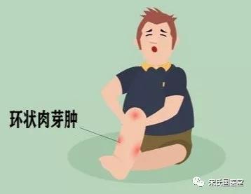糖尿病与皮肤有什么关系,什么样的皮肤病一直反反复复