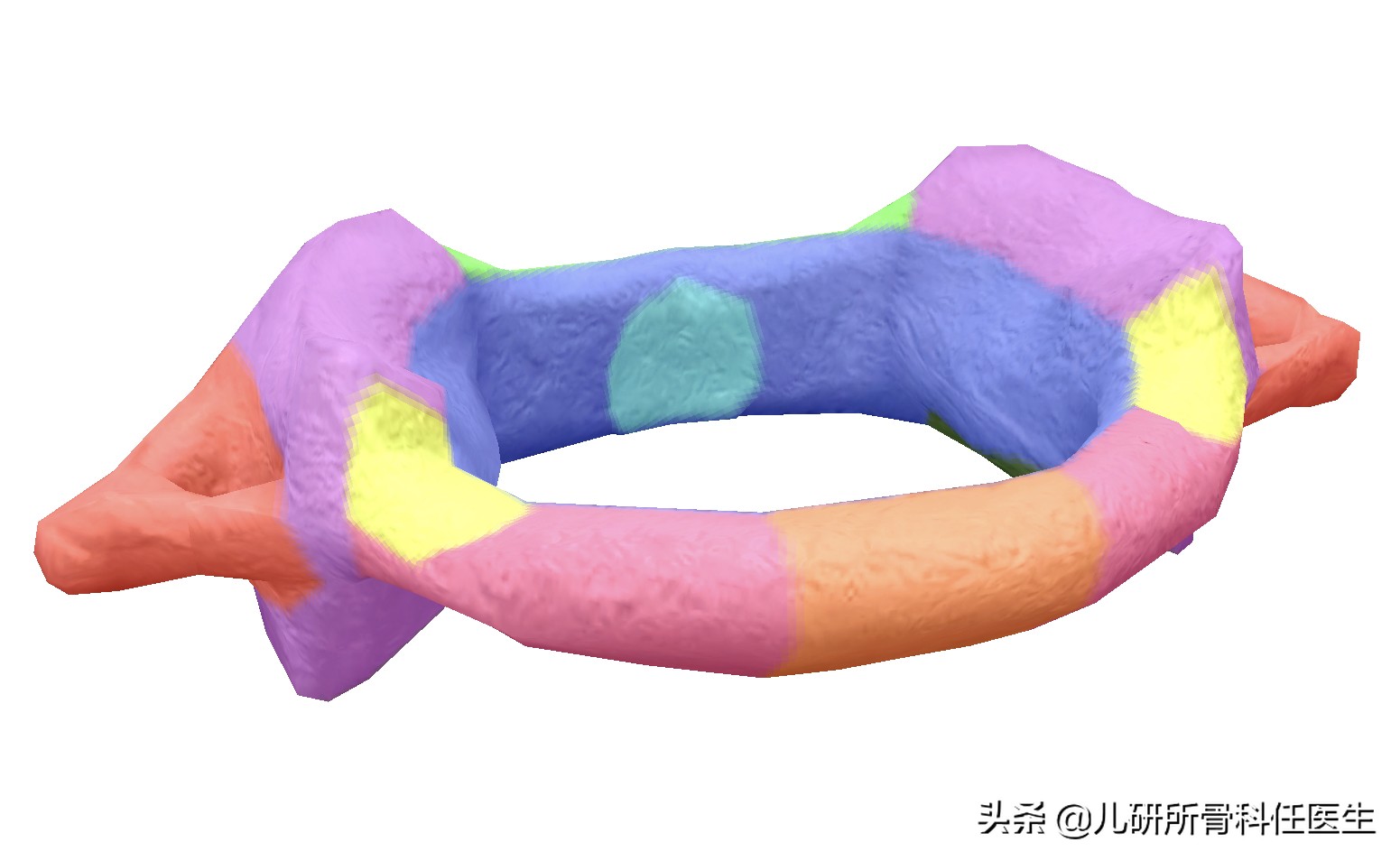 宝宝脖子突然歪了怎么办,小孩脖子落枕了头一直歪着怎么办