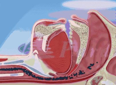 新冠肺炎重症用的机器,机械的力量