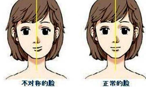 隆鼻几年发现鼻子有点歪,隆鼻鼻子做歪了怎么办