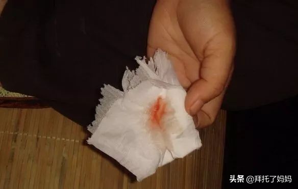 宝宝鼻涕颜色能反映出病情,宝宝鼻涕什么样算快好了