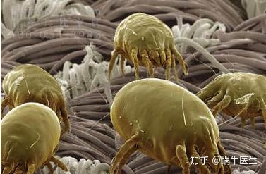 有这几个情况说明你该清理螨虫了,头皮上长小红疙瘩是螨虫导致的吗