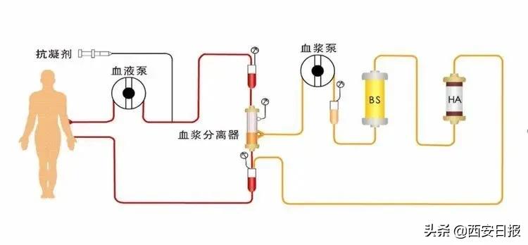 清肝排肝毒最好方法,疏肝排肝毒最好的方法