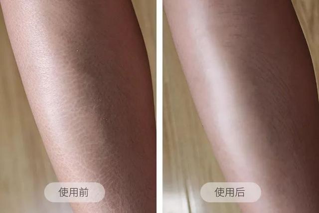 冉莹颖穿10小时高跟鞋，脱鞋后“触目惊心”，女人为了美真是拼了