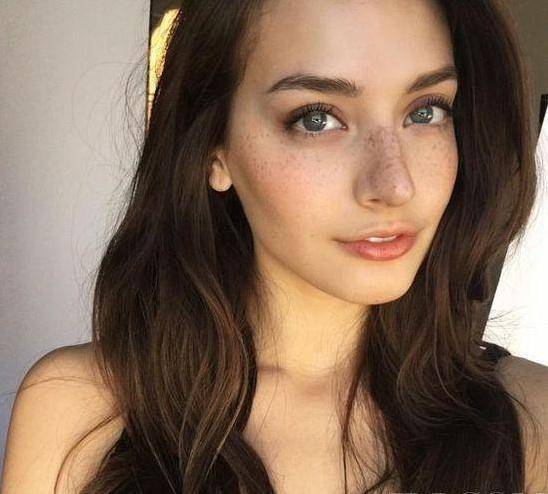 色斑的科普小知识|种类、形成的原理及因素