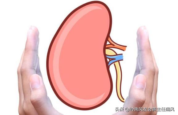 痛风患肾结石的概率高吗,痛风患者患肾结石的几率高吗