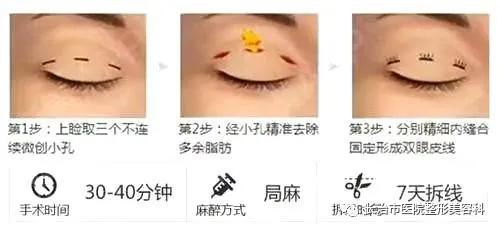 揭秘整形双眼皮内幕,割双眼皮术的价格