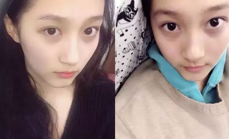 去细纹的电动眼霜,能熨平皱纹的眼霜