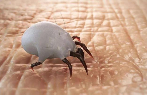 皮肤发痒像虫爬,皮肤发痒感觉有虫子爬过