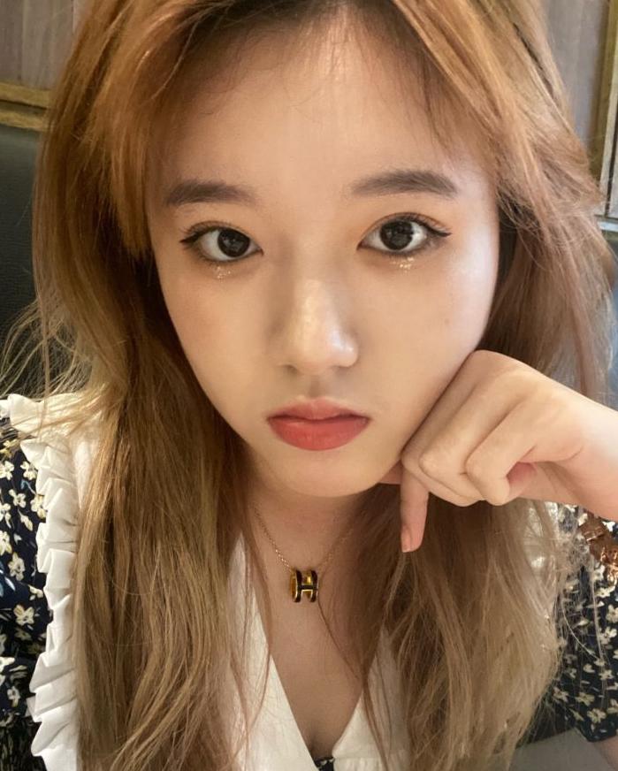 全切提肌案例,姐妹们做全切双眼皮都多少钱