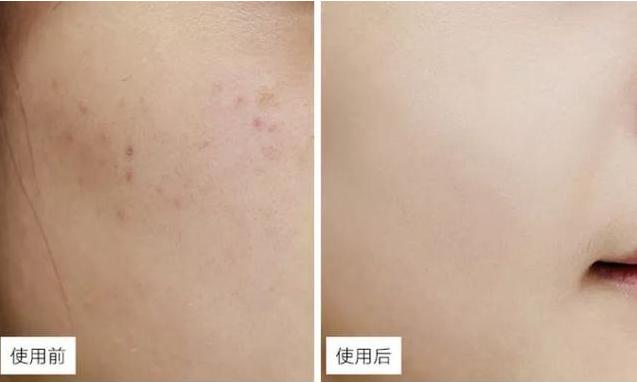 药店有一种“佑颜神药”,皮肤越擦越白嫩,关键不贵,遇到别错过