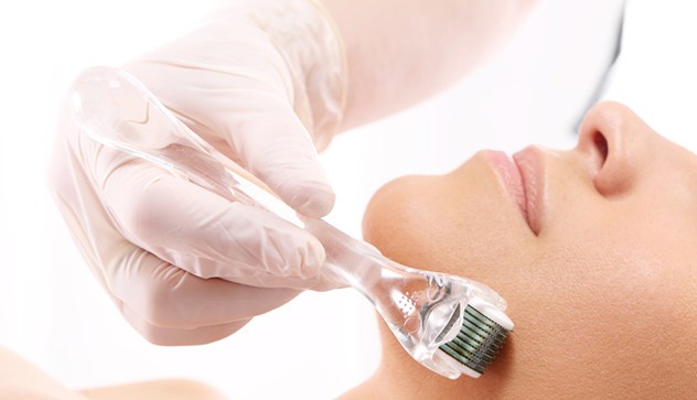 微针感受,微针真的很疼吗