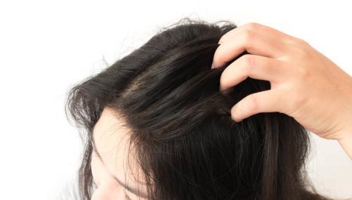 专治大油头的洗发露,拿什么洗发水拯救你的油头