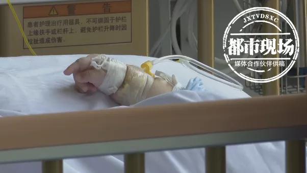 两岁宝宝吃芒果后干呕白沫,孩子吃芒果过敏死亡