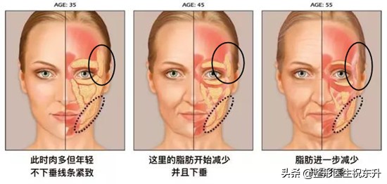 颧骨高太阳穴凹陷额头窄怎么修容,太阳穴凹陷与额头有明显棱角面相