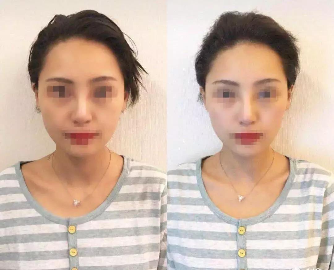 小红书网红景点翻车,小红书红着红着就黄了