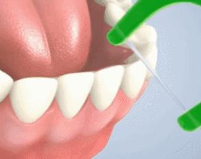 草莓籽藏在牙里发芽了,草莓籽在嘴里发芽