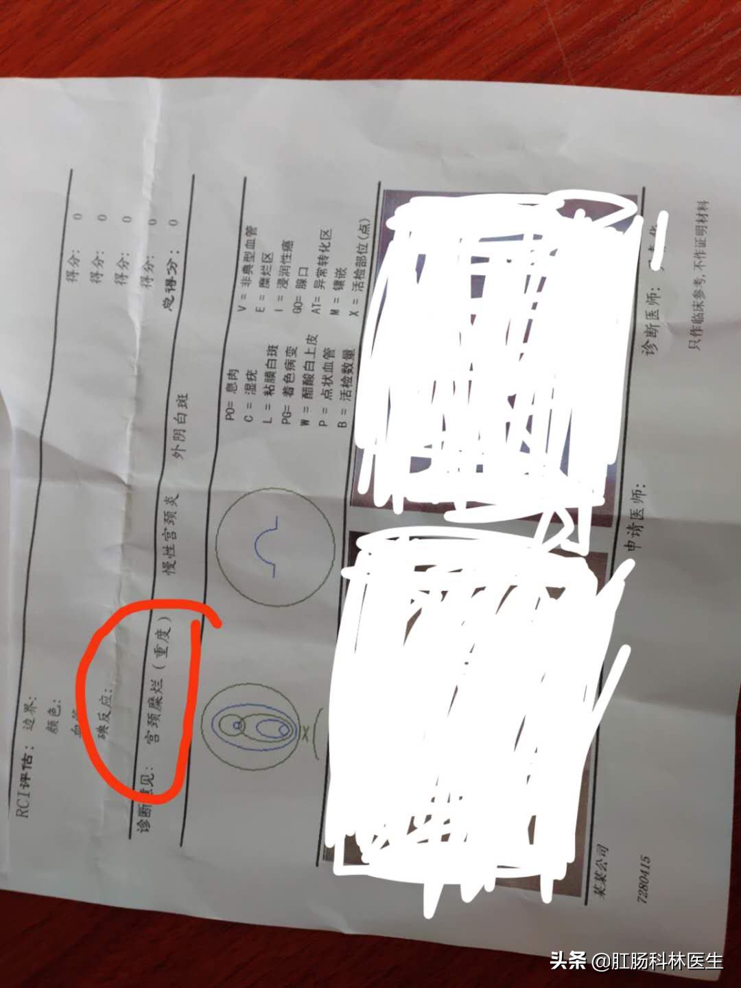 宫颈糜烂二度要不要做leep刀手术,宫颈糜烂做leep刀手术的利弊