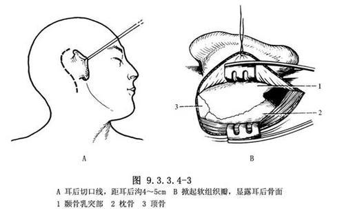 头晕耳鸣听力下降,头晕脑胀听力下降怎么回事