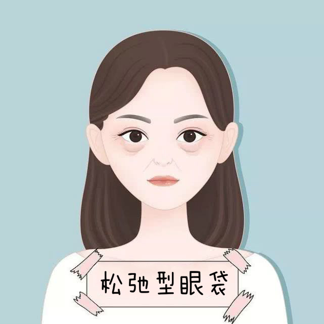 别让眼袋泪沟耽误你的美丽,不要让眼袋影响了你的颜值