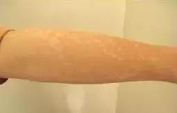 祛斑面诊必背知识点,要祛斑