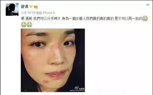 脸一换季就过敏怎么办,换季脸部过敏最快的补救方法