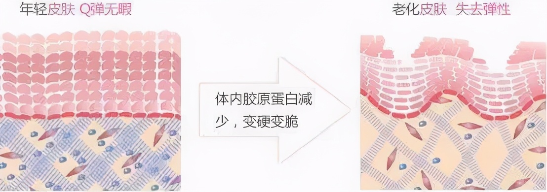 黑头粉刺毛孔粗大怎么隐形毛孔,毛孔粗大cc霜怎么用才能隐形毛孔