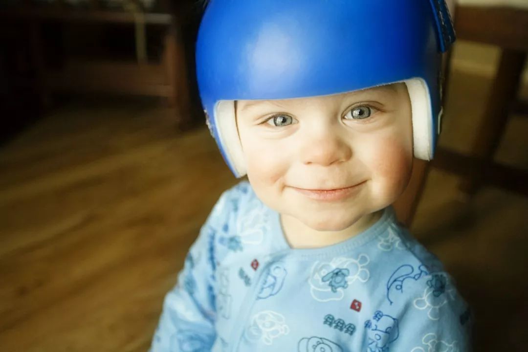 偏头会影响协调性吗,偏头对大脑的影响