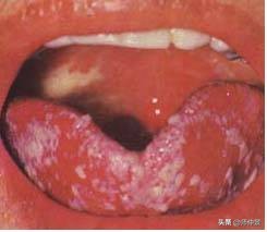 最实用的舌诊图六大舌象,舌诊深入学习书