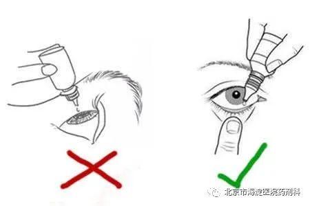 眼睛不舒服用什么滴眼液最好,眼睛不舒服怎么按穴位缓解
