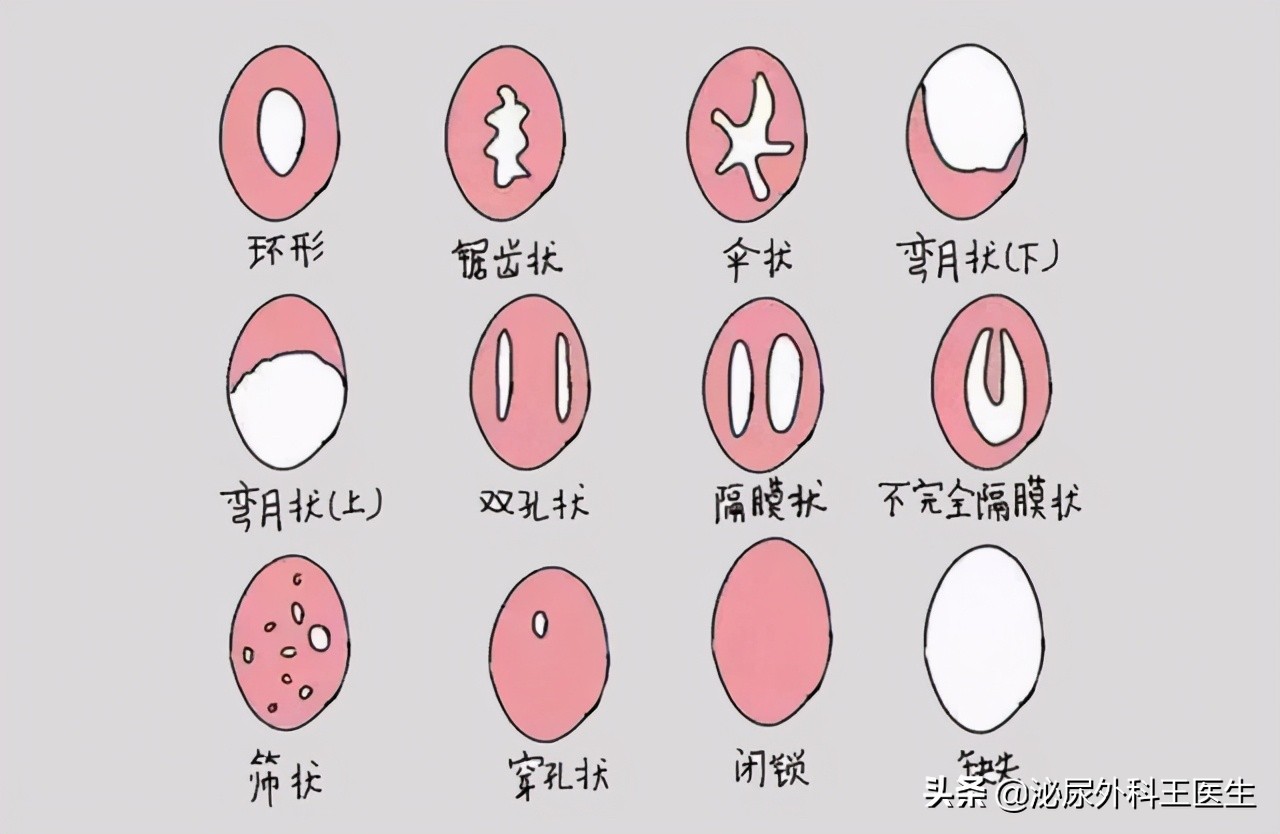 阴式b超是查什么的,阴式b超会检查出什么