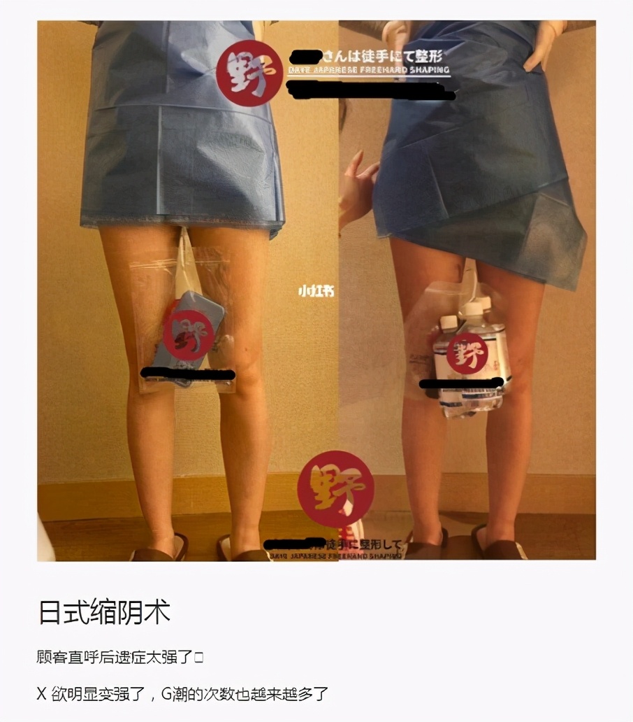 网红凝胶真的有用吗,网络上的调经方法靠谱吗